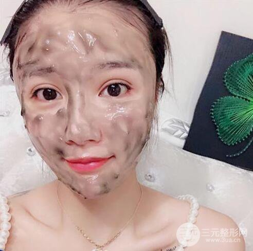 辣媽做了自體脂肪填充全臉，對比圖分享