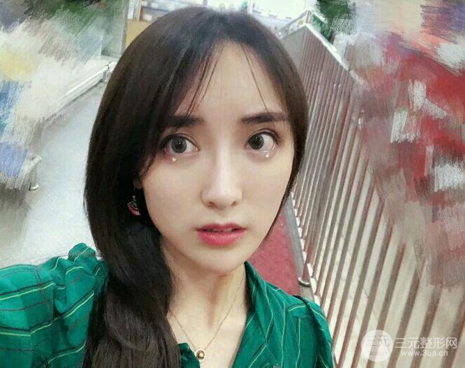 東莞寶格麗韋文奇隆鼻整形果圖分享，對比曝光