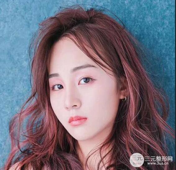 杭州恒顏醫(yī)療美容趙德星隆鼻整形手術(shù)恢復(fù)過程圖