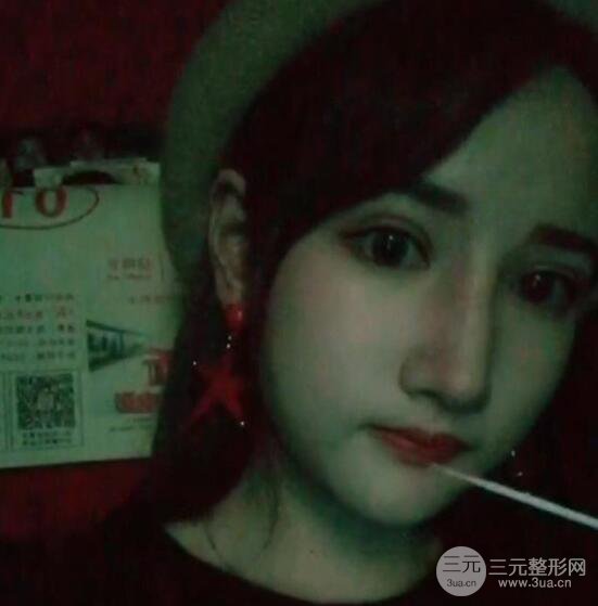 去下頜角+顴骨內(nèi)推手術(shù)三個月記錄，看大臉妹如何逆襲