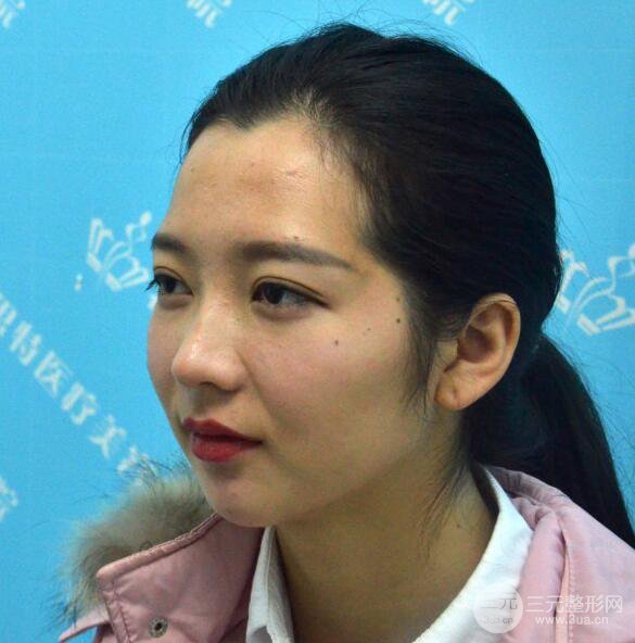 長(zhǎng)得太著急是怎樣一種體驗(yàn)？妹子血淚分享自體脂肪填充詳細(xì)部年輕化經(jīng)驗(yàn)