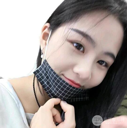 泉州億星醫(yī)療美容閔英俊膨體隆鼻果展示