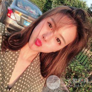 自體脂肪面部填充恢復(fù)自然果圖