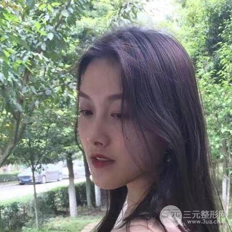 做了“埋埋蛋白線.提升+隆鼻整形”，恢復后老公說很沒有降低風險感