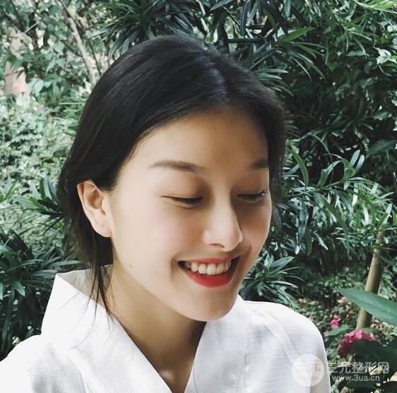 做了“埋埋蛋白線.提升+隆鼻整形”，恢復后老公說很沒有降低風險感