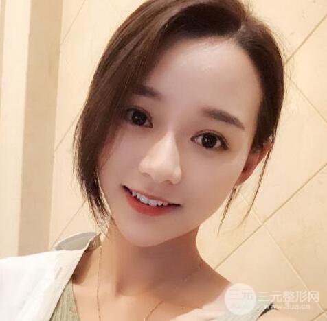 自體脂肪全臉填充三個(gè)月恢復(fù)圖，真實(shí)案例分享