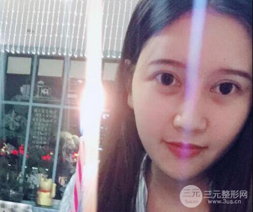 宜昌美岸醫(yī)療美容李英華自體脂肪面部填充怎么樣？真人日記曝光