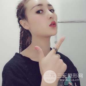 進口假體+肋軟骨墊鼻尖三個月果恢復對比圖