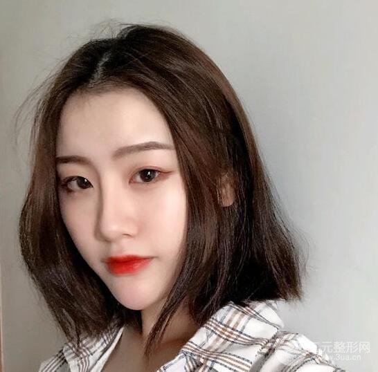 膨體隆鼻三十天恢復(fù)記錄，術(shù)前術(shù)后對比圖片曝光