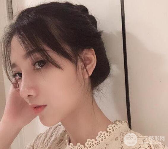 隆鼻整形手術(shù)三個(gè)月后真人果圖