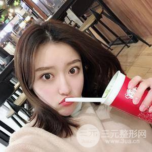 面部吸脂100天恢復(fù)果對(duì)比圖