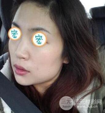 談一談我的磨骨瘦臉經(jīng)歷