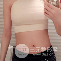 自體脂肪隆胸恢復(fù)圖曝光，見(jiàn)證從A到C的蛻變