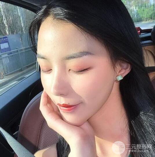 凸嘴先別急著正頜，做個隆鼻整形會更美