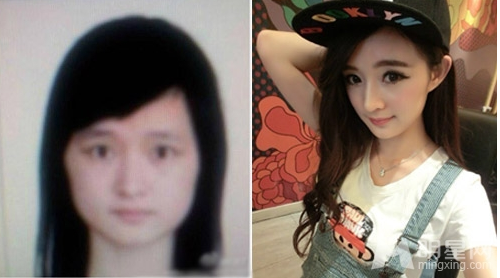 陳丹婷整容前舊照曝光,整形前后對(duì)比圖