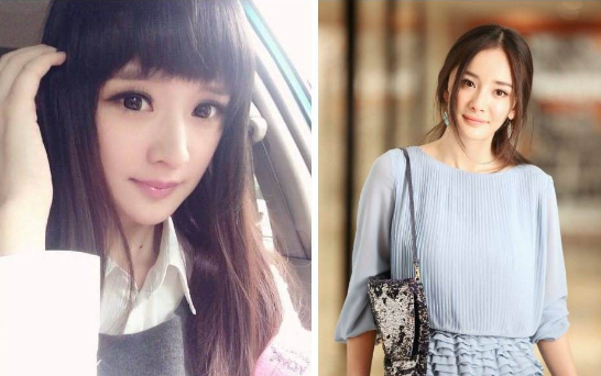 眼睛整形手術(shù)，陳丹婷整容前舊照曝光