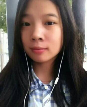 八大處靳小雷埋線雙眼皮一個多月了，果很好哦~~~