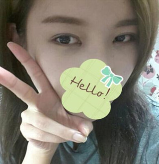 一起來(lái)評(píng)價(jià)一下重慶愛思特盧剛醫(yī)生做的切開雙眼皮吧