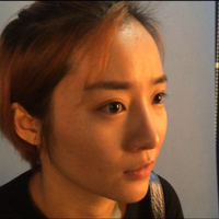 自體脂肪面部填充后我的部看上去好自然宛若天生