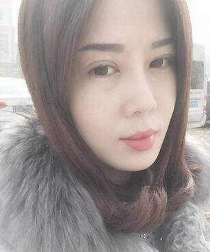 雙眼皮恢復記錄 果很滿意~