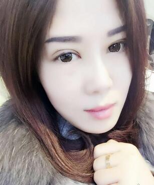 雙眼皮恢復記錄 果很滿意~