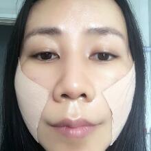 面b提升手術(shù)價(jià)格和真人案例