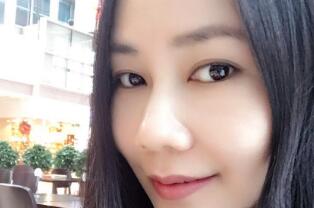 今年1月份去廣州天姿花費(fèi)2800元做了面部緊致手術(shù)--埋埋蛋白線.提升