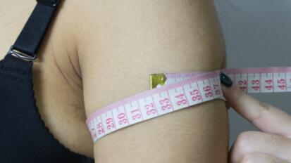 吸脂減肥果能立竿見影，而且不反彈是我較心動的地方