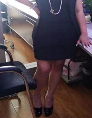 給你們分享麗都醫(yī)生做的吸脂瘦腰腹