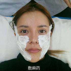 埋蛋白線.提升面部對比圖片，顏值嘩嘩嘩的往上漲!!!