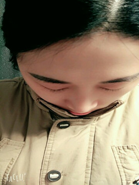 于立民醫(yī)生給我做的隆鼻整形手術(shù)，給大家分享我整形的過程吧!