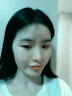 自體脂肪填充下巴前后對比圖，進來看看就知道啦!