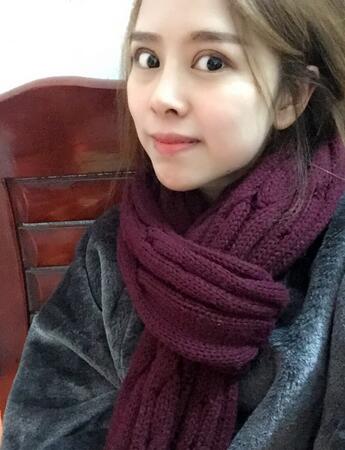 切開(kāi)雙眼皮恢復(fù)過(guò)程 心路分享~