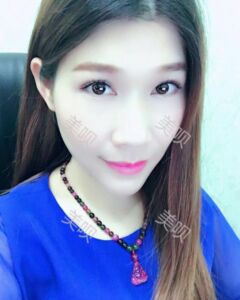 在廣州締妍做了內(nèi)切去眼袋后年輕多了