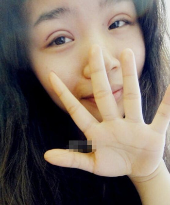 你們來看看藝美門智和做的埋線雙眼皮，瞬間變大眼美女