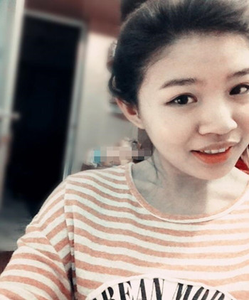 你們來看看藝美門智和做的埋線雙眼皮，瞬間變大眼美女