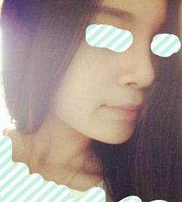 藝美門智和綜合隆鼻，你值得擁有