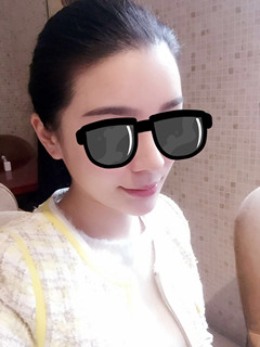 藝美王東做的自體脂肪填充面部，要的就是這個(gè)范兒