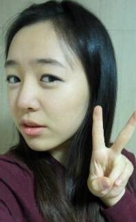 耳軟骨隆鼻前后過程圖片，見證我變美的過程