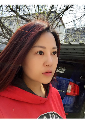 自體脂肪填充面部前后對比圖片，真的美了美了!