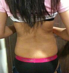 北京禾美嘉腹部吸脂 可以自信地秀出小蠻腰啦！