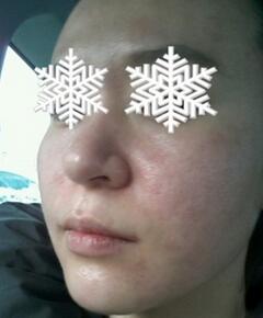 北京禾美嘉彩光嫩膚 果不錯(cuò)哦~