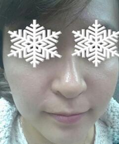 北京禾美嘉彩光嫩膚 果不錯(cuò)哦~