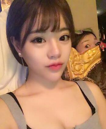 北京禾美嘉注射玻尿酸豐唇+豐臥蠶 讓我更美啦~