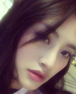 趙煜楠給做的隆鼻整形，看看我鼻子果怎么樣