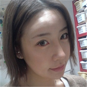 百*麗沈國(guó)雄做的隆鼻失敗修復(fù)，恢復(fù)果很好，還有前后對(duì)比照片！