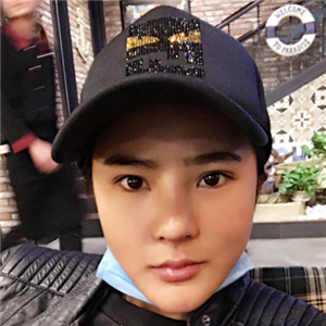 分享一下我的隆鼻失敗修復(fù)前后對(duì)比果圖片，沈國(guó)雄做的哦~