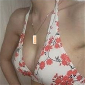 南昌同濟(jì)做的極速動感微創(chuàng)豐胸術(shù)，分享下我的恢復(fù)過程圖片吧~