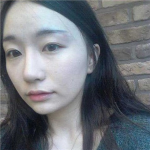 趙雅雄做下頜角整形成好嗎？看看我的前后對比圖片就知道了~