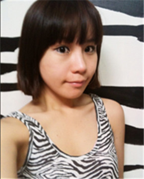 下頜角整形做完變小臉 孫麗君醫(yī)生棒棒噠